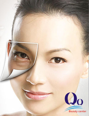 Điều trị thâm quầng mắt Dieu tri tham quang mat
